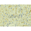 DF6870 staining HepG2 by IF/ICC. The sample were fixed with PFA and permeabilized in 0.1% Triton X-100,then blocked in 10% serum for 45 minutes at 25¡ãC. The primary antibody was diluted at 1/200 and incubated with the sample for 1 hour at 37¡ãC. An  Alexa Fluor 594 conjugated goat anti-rabbit IgG (H+L) Ab, diluted at 1/600, was used as the secondary antibod