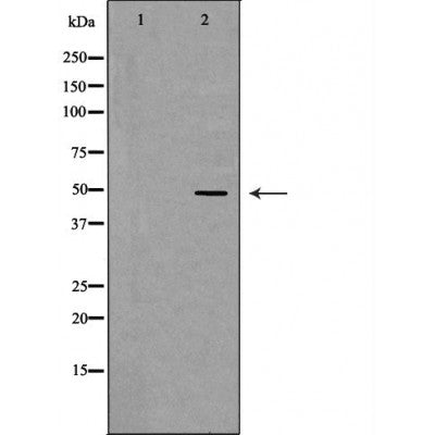 DF6871 at 1/100 staining Mouse liver tissue by IHC-P. The sample was formaldehyde fixed and a heat mediated antigen retrieval step in citrate buffer was performed. The sample was then blocked and incubated with the antibody for 1.5 hours at 22¡ãC. An HRP conjugated goat anti-rabbit antibody was used as the secondary