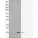 DF6872 at 1/100 staining Mouse testis tissue by IHC-P. The sample was formaldehyde fixed and a heat mediated antigen retrieval step in citrate buffer was performed. The sample was then blocked and incubated with the antibody for 1.5 hours at 22¡ãC. An HRP conjugated goat anti-rabbit antibody was used as the secondary