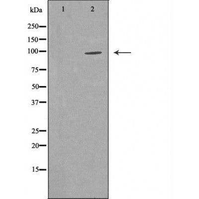 Western blot analysis of Hela whole cell lysates, using MIWI Antibody. The lane on the left is treated with the antigen-specific peptide.