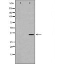 DF6876 at 1/100 staining Mouse testis tissue by IHC-P. The sample was formaldehyde fixed and a heat mediated antigen retrieval step in citrate buffer was performed. The sample was then blocked and incubated with the antibody for 1.5 hours at 22¡ãC. An HRP conjugated goat anti-rabbit antibody was used as the secondary