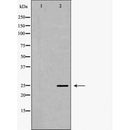 Western blot analysis of extracts of U-87, using SCN4B antibody. The lane on the left is treated with the antigen-specific peptide.
