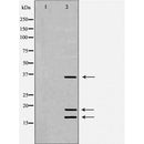 DF6879 staining  Hela cells by IF/ICC. The sample were fixed with PFA and permeabilized in 0.1% Triton X-100,then blocked in 10% serum for 45 minutes at 25¡ãC. The primary antibody was diluted at 1/200 and incubated with the sample for 1 hour at 37¡ãC. An  Alexa Fluor 594 conjugated goat anti-rabbit IgG (H+L) antibody(Cat.