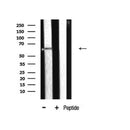 DF6883 at 1/100 staining Human cervical cancer tissue by IHC-P. The sample was formaldehyde fixed and a heat mediated antigen retrieval step in citrate buffer was performed. The sample was then blocked and incubated with the antibody for 1.5 hours at 22¡ãC. An HRP conjugated goat anti-rabbit antibody was used as the secondary