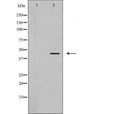 DF6886 at 1/100 staining Mouse testis tissue by IHC-P. The sample was formaldehyde fixed and a heat mediated antigen retrieval step in citrate buffer was performed. The sample was then blocked and incubated with the antibody for 1.5 hours at 22¡ãC. An HRP conjugated goat anti-rabbit antibody was used as the secondary
