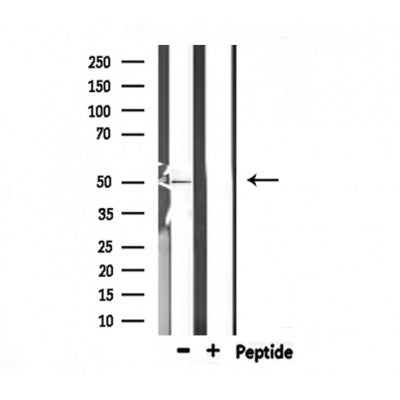 DF6889 at 1/100 staining Mouse liver tissue by IHC-P. The sample was formaldehyde fixed and a heat mediated antigen retrieval step in citrate buffer was performed. The sample was then blocked and incubated with the antibody for 1.5 hours at 22¡ãC. An HRP conjugated goat anti-rabbit antibody was used as the secondary