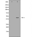 DF6890 at 1/100 staining Human gastric tissue by IHC-P. The sample was formaldehyde fixed and a heat mediated antigen retrieval step in citrate buffer was performed. The sample was then blocked and incubated with the antibody for 1.5 hours at 22¡ãC. An HRP conjugated goat anti-rabbit antibody was used as the secondary