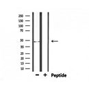 DF6892 at 1/100 staining Human gastric tissue by IHC-P. The sample was formaldehyde fixed and a heat mediated antigen retrieval step in citrate buffer was performed. The sample was then blocked and incubated with the antibody for 1.5 hours at 22¡ãC. An HRP conjugated goat anti-rabbit antibody was used as the secondary