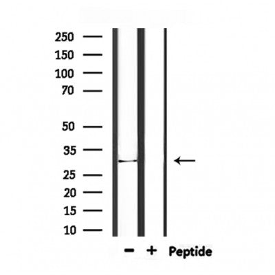 DF6893 at 1/100 staining Human uterus tissue by IHC-P. The sample was formaldehyde fixed and a heat mediated antigen retrieval step in citrate buffer was performed. The sample was then blocked and incubated with the antibody for 1.5 hours at 22¡ãC. An HRP conjugated goat anti-rabbit antibody was used as the secondary