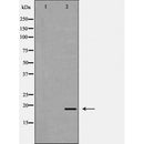 DF6894 staining HepG2 by IF/ICC. The sample were fixed with PFA and permeabilized in 0.1% Triton X-100,then blocked in 10% serum for 45 minutes at 25¡ãC. The primary antibody was diluted at 1/200 and incubated with the sample for 1 hour at 37¡ãC. An  Alexa Fluor 594 conjugated goat anti-rabbit IgG (H+L) Ab, diluted at 1/600, was used as the secondary antibod