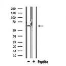 DF6897 at 1/100 staining Mouse lung tissue by IHC-P. The sample was formaldehyde fixed and a heat mediated antigen retrieval step in citrate buffer was performed. The sample was then blocked and incubated with the antibody for 1.5 hours at 22¡ãC. An HRP conjugated goat anti-rabbit antibody was used as the secondary