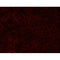 E-cadherin for IHC in human HepG2,Provided by Tianjin University