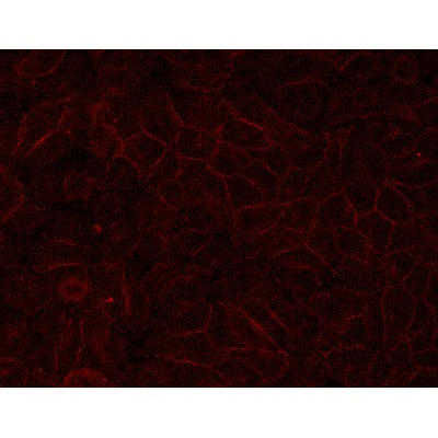 E-cadherin for IHC in human HepG2,Provided by Tianjin University