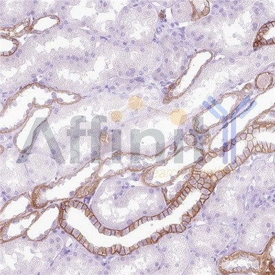 IHC analysis.