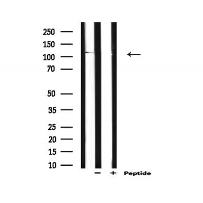 Western blot analysis of extracts from mouse brain, using E-cadherin Antibody.