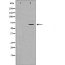 DF6901 at 1/100 staining Mouse testis tissue by IHC-P. The sample was formaldehyde fixed and a heat mediated antigen retrieval step in citrate buffer was performed. The sample was then blocked and incubated with the antibody for 1.5 hours at 22¡ãC. An HRP conjugated goat anti-rabbit antibody was used as the secondary