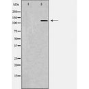 DF6903 at 1/100 staining Human gastric tissue by IHC-P. The sample was formaldehyde fixed and a heat mediated antigen retrieval step in citrate buffer was performed. The sample was then blocked and incubated with the antibody for 1.5 hours at 22¡ãC. An HRP conjugated goat anti-rabbit antibody was used as the secondary