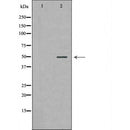 DF6904 at 1/100 staining Human Melanoma tissue by IHC-P. The sample was formaldehyde fixed and a heat mediated antigen retrieval step in citrate buffer was performed. The sample was then blocked and incubated with the antibody for 1.5 hours at 22¡ãC. An HRP conjugated goat anti-rabbit antibody was used as the secondary