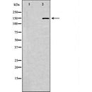 DF6905 at 1/100 staining Human prostate tissue by IHC-P. The sample was formaldehyde fixed and a heat mediated antigen retrieval step in citrate buffer was performed. The sample was then blocked and incubated with the antibody for 1.5 hours at 22¡ãC. An HRP conjugated goat anti-rabbit antibody was used as the secondary