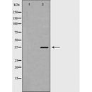 DF6915 staining Hela by IF/ICC. The sample were fixed with PFA and permeabilized in 0.1% Triton X-100,then blocked in 10% serum for 45 minutes at 25¡ãC. The primary antibody was diluted at 1/200 and incubated with the sample for 1 hour at 37¡ãC. An  Alexa Fluor 594 conjugated goat anti-rabbit IgG (H+L) Ab, diluted at 1/600, was used as the secondary antibod