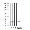 DF6916 at 1/100 staining Mouse testis tissue by IHC-P. The sample was formaldehyde fixed and a heat mediated antigen retrieval step in citrate buffer was performed. The sample was then blocked and incubated with the antibody for 1.5 hours at 22¡ãC. An HRP conjugated goat anti-rabbit antibody was used as the secondary