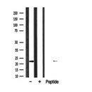 DF6919 staining MCF7 by IF/ICC. The sample were fixed with PFA and permeabilized in 0.1% Triton X-100,then blocked in 10% serum for 45 minutes at 25¡ãC. The primary antibody was diluted at 1/200 and incubated with the sample for 1 hour at 37¡ãC. An  Alexa Fluor 594 conjugated goat anti-rabbit IgG (H+L) Ab, diluted at 1/600, was used as the secondary antibod