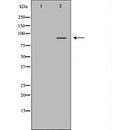 DF6930 staining HepG2 by IF/ICC. The sample were fixed with PFA and permeabilized in 0.1% Triton X-100,then blocked in 10% serum for 45 minutes at 25¡ãC. The primary antibody was diluted at 1/200 and incubated with the sample for 1 hour at 37¡ãC. An  Alexa Fluor 594 conjugated goat anti-rabbit IgG (H+L) Ab, diluted at 1/600, was used as the secondary antibod