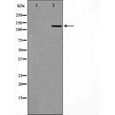 DF6931 staining HepG2 by IF/ICC. The sample were fixed with PFA and permeabilized in 0.1% Triton X-100,then blocked in 10% serum for 45 minutes at 25¡ãC. The primary antibody was diluted at 1/200 and incubated with the sample for 1 hour at 37¡ãC. An  Alexa Fluor 594 conjugated goat anti-rabbit IgG (H+L) Ab, diluted at 1/600, was used as the secondary antibod