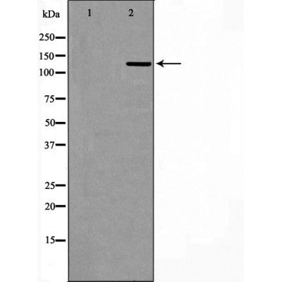 DF6931 staining HepG2 by IF/ICC. The sample were fixed with PFA and permeabilized in 0.1% Triton X-100,then blocked in 10% serum for 45 minutes at 25¡ãC. The primary antibody was diluted at 1/200 and incubated with the sample for 1 hour at 37¡ãC. An  Alexa Fluor 594 conjugated goat anti-rabbit IgG (H+L) Ab, diluted at 1/600, was used as the secondary antibod