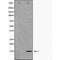 DF6932 staining HepG2 by IF/ICC. The sample were fixed with PFA and permeabilized in 0.1% Triton X-100,then blocked in 10% serum for 45 minutes at 25¡ãC. The primary antibody was diluted at 1/200 and incubated with the sample for 1 hour at 37¡ãC. An  Alexa Fluor 594 conjugated goat anti-rabbit IgG (H+L) Ab, diluted at 1/600, was used as the secondary antibod