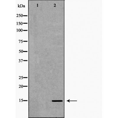 DF6932 staining HepG2 by IF/ICC. The sample were fixed with PFA and permeabilized in 0.1% Triton X-100,then blocked in 10% serum for 45 minutes at 25¡ãC. The primary antibody was diluted at 1/200 and incubated with the sample for 1 hour at 37¡ãC. An  Alexa Fluor 594 conjugated goat anti-rabbit IgG (H+L) Ab, diluted at 1/600, was used as the secondary antibod