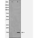 DF6934 staining HepG2 by IF/ICC. The sample were fixed with PFA and permeabilized in 0.1% Triton X-100,then blocked in 10% serum for 45 minutes at 25¡ãC. The primary antibody was diluted at 1/200 and incubated with the sample for 1 hour at 37¡ãC. An  Alexa Fluor 594 conjugated goat anti-rabbit IgG (H+L) Ab, diluted at 1/600, was used as the secondary antibod