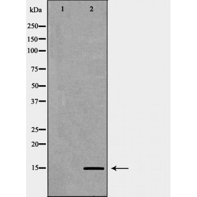 DF6937 staining HepG2 by IF/ICC. The sample were fixed with PFA and permeabilized in 0.1% Triton X-100,then blocked in 10% serum for 45 minutes at 25¡ãC. The primary antibody was diluted at 1/200 and incubated with the sample for 1 hour at 37¡ãC. An  Alexa Fluor 594 conjugated goat anti-rabbit IgG (H+L) Ab, diluted at 1/600, was used as the secondary antibod