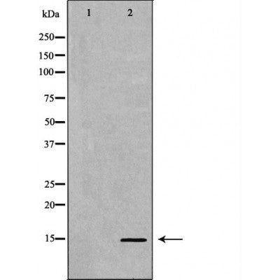 DF6938 staining HepG2 by IF/ICC. The sample were fixed with PFA and permeabilized in 0.1% Triton X-100,then blocked in 10% serum for 45 minutes at 25¡ãC. The primary antibody was diluted at 1/200 and incubated with the sample for 1 hour at 37¡ãC. An  Alexa Fluor 594 conjugated goat anti-rabbit IgG (H+L) Ab, diluted at 1/600, was used as the secondary antibod