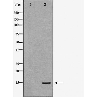 DF6939 staining HepG2 by IF/ICC. The sample were fixed with PFA and permeabilized in 0.1% Triton X-100,then blocked in 10% serum for 45 minutes at 25¡ãC. The primary antibody was diluted at 1/200 and incubated with the sample for 1 hour at 37¡ãC. An  Alexa Fluor 594 conjugated goat anti-rabbit IgG (H+L) Ab, diluted at 1/600, was used as the secondary antibod