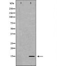 DF6940 staining HepG2 by IF/ICC. The sample were fixed with PFA and permeabilized in 0.1% Triton X-100,then blocked in 10% serum for 45 minutes at 25¡ãC. The primary antibody was diluted at 1/200 and incubated with the sample for 1 hour at 37¡ãC. An  Alexa Fluor 594 conjugated goat anti-rabbit IgG (H+L) Ab, diluted at 1/600, was used as the secondary antibod