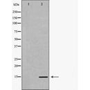 DF6942 staining HepG2 by IF/ICC. The sample were fixed with PFA and permeabilized in 0.1% Triton X-100,then blocked in 10% serum for 45 minutes at 25¡ãC. The primary antibody was diluted at 1/200 and incubated with the sample for 1 hour at 37¡ãC. An  Alexa Fluor 594 conjugated goat anti-rabbit IgG (H+L) Ab, diluted at 1/600, was used as the secondary antibod