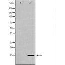 DF6943 staining HepG2 by IF/ICC. The sample were fixed with PFA and permeabilized in 0.1% Triton X-100,then blocked in 10% serum for 45 minutes at 25¡ãC. The primary antibody was diluted at 1/200 and incubated with the sample for 1 hour at 37¡ãC. An  Alexa Fluor 594 conjugated goat anti-rabbit IgG (H+L) Ab, diluted at 1/600, was used as the secondary antibod