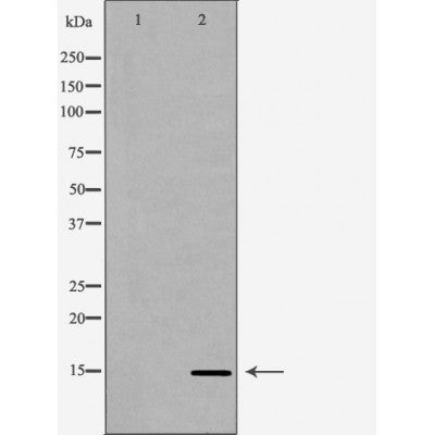 DF6945 staining HepG2 by IF/ICC. The sample were fixed with PFA and permeabilized in 0.1% Triton X-100,then blocked in 10% serum for 45 minutes at 25¡ãC. The primary antibody was diluted at 1/200 and incubated with the sample for 1 hour at 37¡ãC. An  Alexa Fluor 594 conjugated goat anti-rabbit IgG (H+L) Ab, diluted at 1/600, was used as the secondary antibod