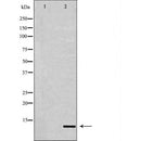 DF6949 staining Hela by IF/ICC. The sample were fixed with PFA and permeabilized in 0.1% Triton X-100,then blocked in 10% serum for 45 minutes at 25¡ãC. The primary antibody was diluted at 1/200 and incubated with the sample for 1 hour at 37¡ãC. An  Alexa Fluor 594 conjugated goat anti-rabbit IgG (H+L) Ab, diluted at 1/600, was used as the secondary antibod