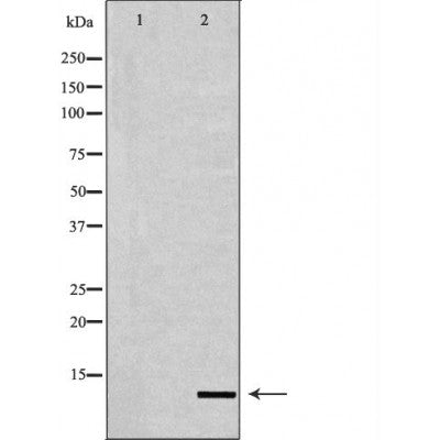 DF6949 staining Hela by IF/ICC. The sample were fixed with PFA and permeabilized in 0.1% Triton X-100,then blocked in 10% serum for 45 minutes at 25¡ãC. The primary antibody was diluted at 1/200 and incubated with the sample for 1 hour at 37¡ãC. An  Alexa Fluor 594 conjugated goat anti-rabbit IgG (H+L) Ab, diluted at 1/600, was used as the secondary antibod