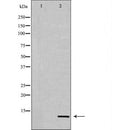 Western blot analysis of Hela whole cell lysates, using Histone H4K20me3 Antibody. The lane on the left is treated with the antigen-specific peptide.