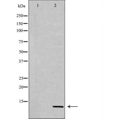 Western blot analysis of Hela whole cell lysates, using Histone H4K20me3 Antibody. The lane on the left is treated with the antigen-specific peptide.