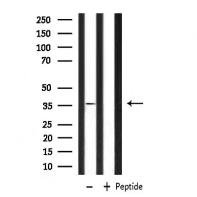 DF6956 staining HepG2 by IF/ICC. The sample were fixed with PFA and permeabilized in 0.1% Triton X-100,then blocked in 10% serum for 45 minutes at 25¡ãC. The primary antibody was diluted at 1/200 and incubated with the sample for 1 hour at 37¡ãC. An  Alexa Fluor 594 conjugated goat anti-rabbit IgG (H+L) Ab, diluted at 1/600, was used as the secondary antibod