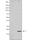 DF6958 at 1/100 staining Human gastric tissue by IHC-P. The sample was formaldehyde fixed and a heat mediated antigen retrieval step in citrate buffer was performed. The sample was then blocked and incubated with the antibody for 1.5 hours at 22¡ãC. An HRP conjugated goat anti-rabbit antibody was used as the secondary