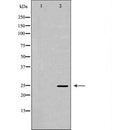 DF6972 at 1/100 staining Mouse spleen tissue by IHC-P. The sample was formaldehyde fixed and a heat mediated antigen retrieval step in citrate buffer was performed. The sample was then blocked and incubated with the antibody for 1.5 hours at 22¡ãC. An HRP conjugated goat anti-rabbit antibody was used as the secondary