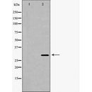 DF6976 at 1/100 staining Rat heart tissue by IHC-P. The sample was formaldehyde fixed and a heat mediated antigen retrieval step in citrate buffer was performed. The sample was then blocked and incubated with the antibody for 1.5 hours at 22¡ãC. An HRP conjugated goat anti-rabbit antibody was used as the secondary