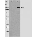 DF6977 at 1/100 staining Rat lung tissue by IHC-P. The sample was formaldehyde fixed and a heat mediated antigen retrieval step in citrate buffer was performed. The sample was then blocked and incubated with the antibody for 1.5 hours at 22¡ãC. An HRP conjugated goat anti-rabbit antibody was used as the secondary