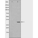 DF6979 at 1/100 staining Rat colon tissue by IHC-P. The sample was formaldehyde fixed and a heat mediated antigen retrieval step in citrate buffer was performed. The sample was then blocked and incubated with the antibody for 1.5 hours at 22¡ãC. An HRP conjugated goat anti-rabbit antibody was used as the secondary