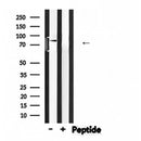 Western blot analysis of extracts from 293, using NEDD9 Antibody. Lane 1 was treated with the antigen-specific peptide.